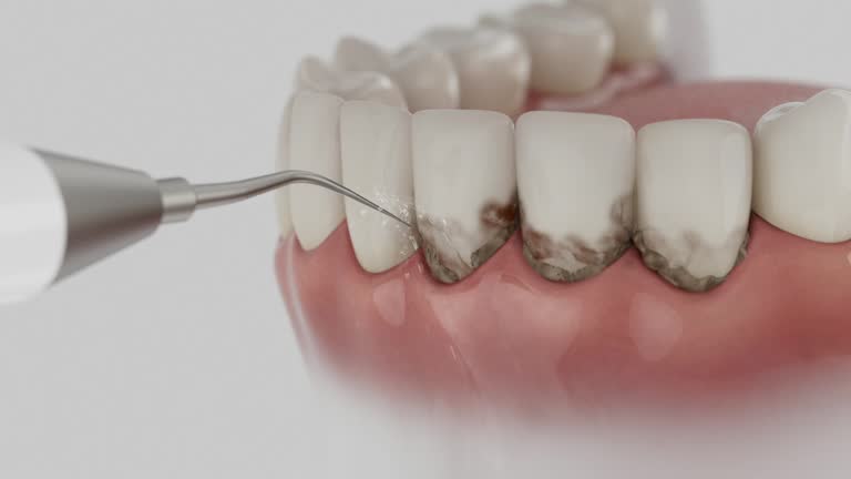 Reliable Dental Implants contractor in Poplarville, MS by Smile Center Dentistry